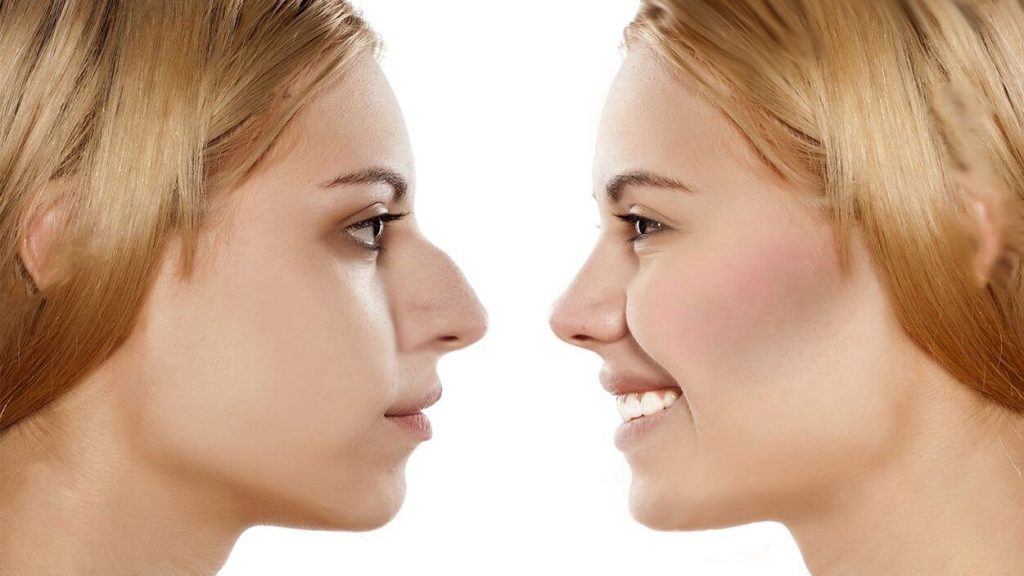 orrplasztika árak budapest